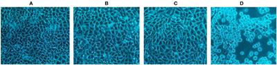 Detection of suid herpesvirus 1 infectivity in pigs by propidium monoazide-qPCR